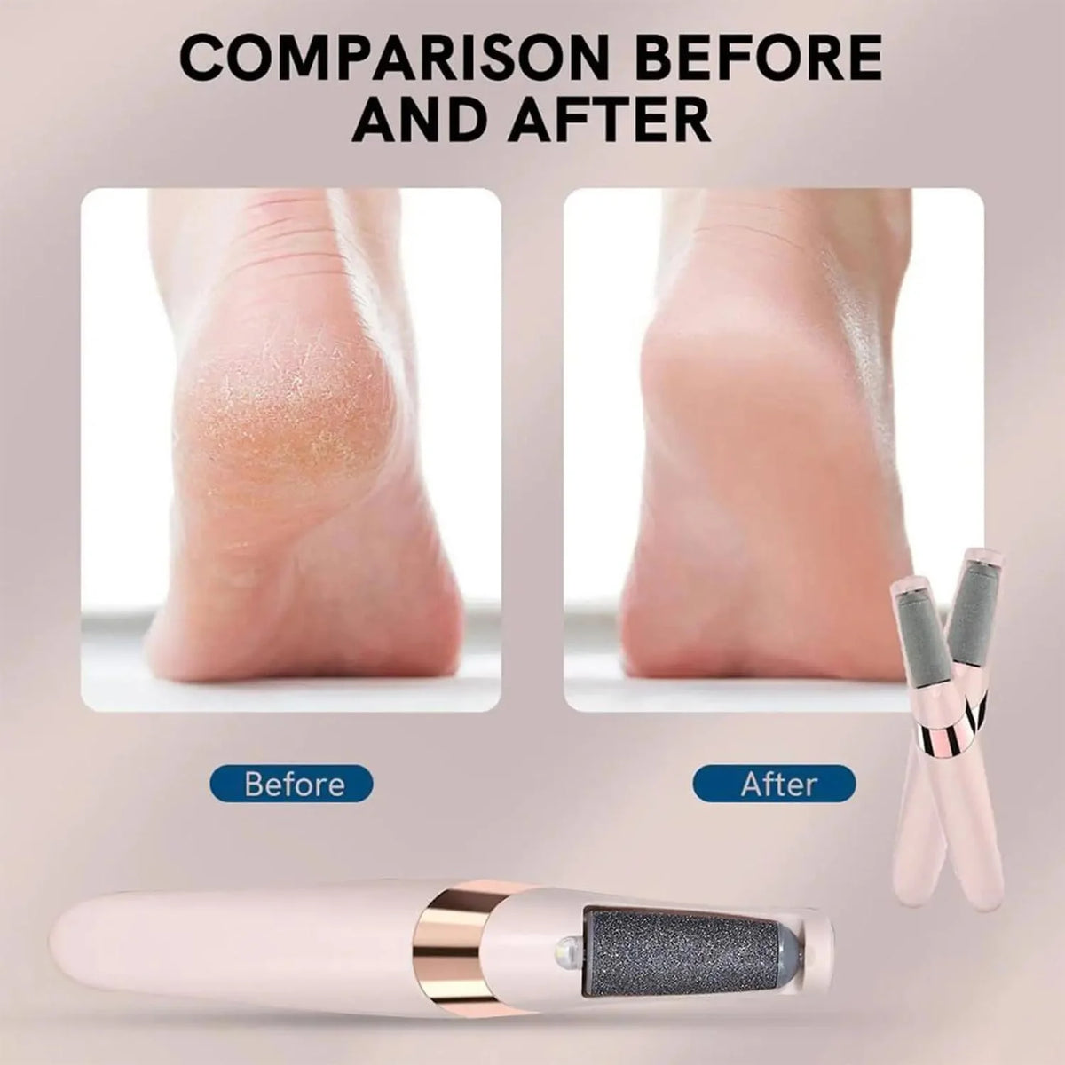 Pedicure Electronic Tool File Feet Callus Remover Hard Skin Remover Foot Care Tools